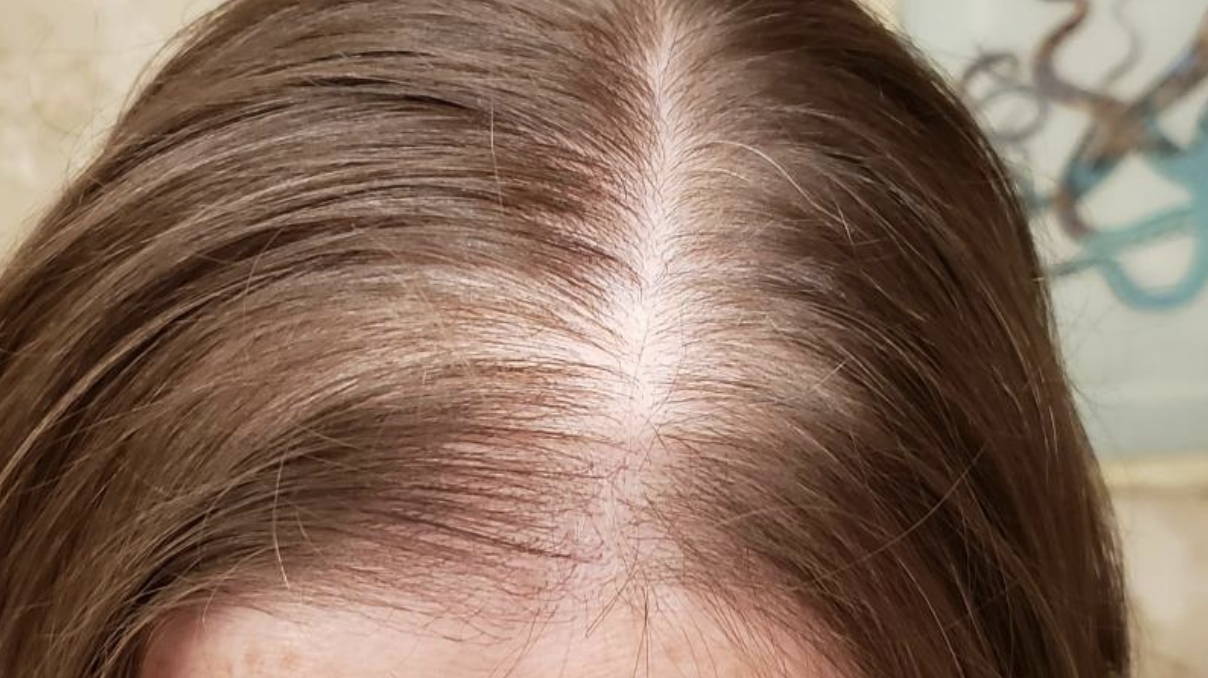 Vortex Wand Pro Vortex Luxury